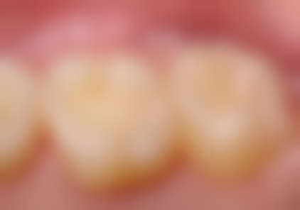 东营凯恩口腔诊所价格表/收费标准