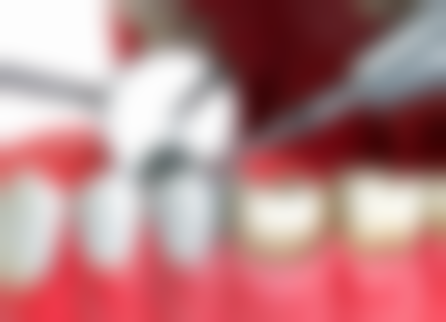 广西防城港防城黄明口腔详细的预约挂号方式及流程