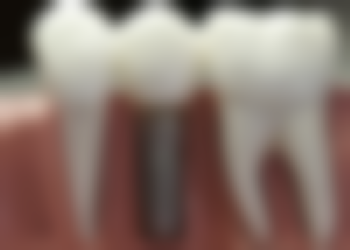 金院长擅长项目