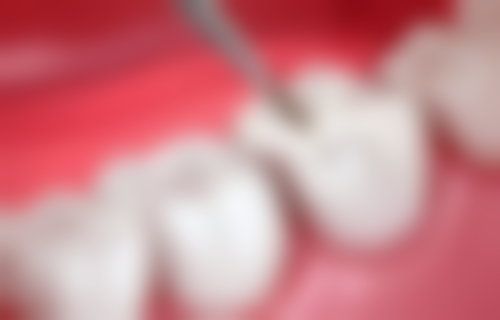 简阳朗朗龄珑口腔门诊部地址电话营业时间