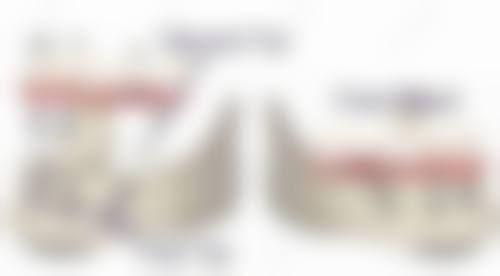 三、骨整合异常是种植牙“不安分”幕后黑手