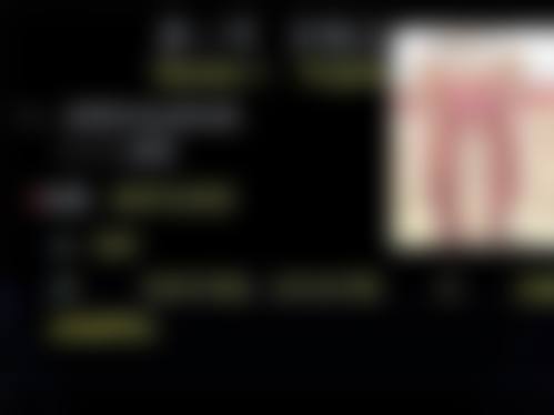 金志平医生技术优势