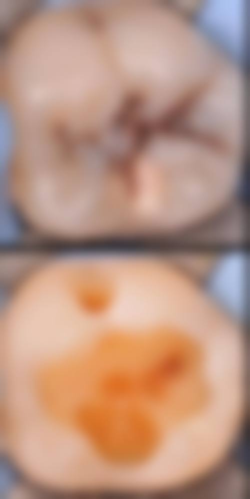 耿蔚灏医生技术优势