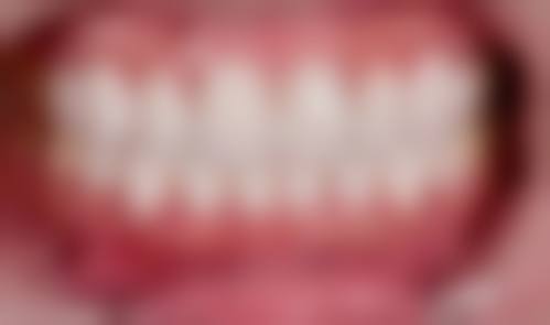 肇庆封开桂风口腔特色项目及技术优势