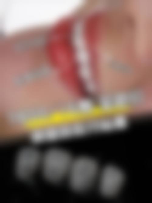 刘兴俊医生口碑评价及真人实例