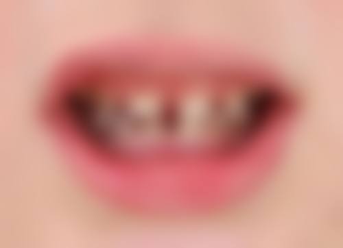 深圳瑞致口腔门诊部机构档次与口碑佳