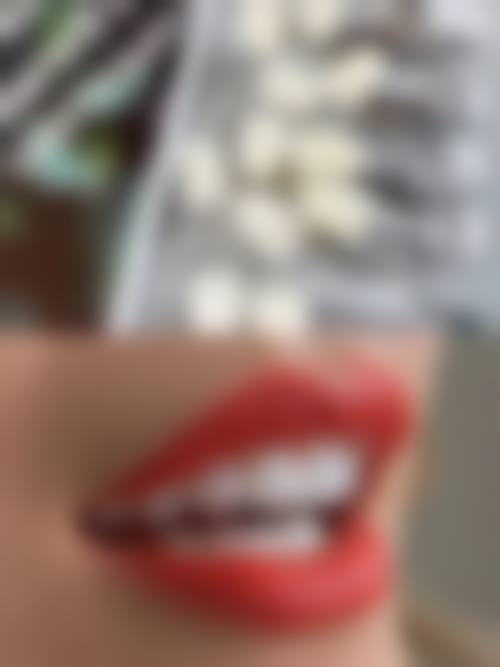 简阳朗朗龄珑口腔门诊部详细的预约挂号方式及流程