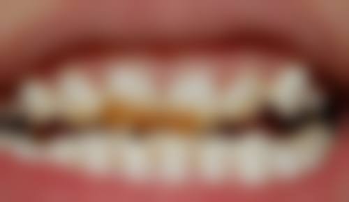 {2026乐清市牙科医院收费价目表在线查询：种牙2800元起、矫正8000元起，技术优口碑好