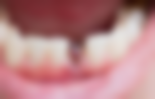 黄征难医生擅长项目