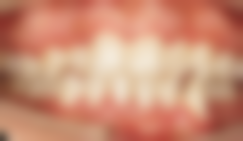 影响早上拔牙前吃早餐的因素