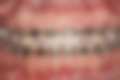 超划算价格:金属矫正低至5800元