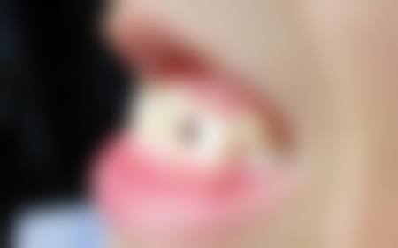 河南洛阳小白兔口腔医院连锁特色项目及技术优势