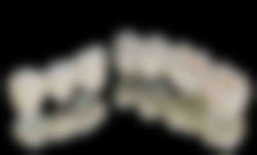 宁波海曙植雅口腔诊所价格表/收费标准