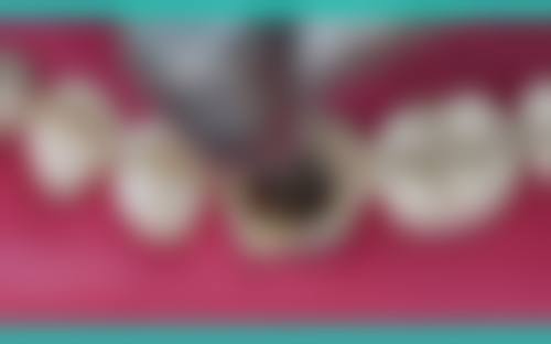 广州陈瑞丹口腔门诊部真人口碑评价怎么样？