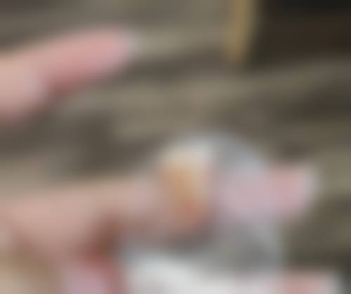 在线询问:24小时守护您的口腔健康