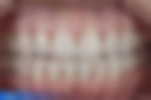 广东东莞济民口腔详细的预约挂号方式及流程