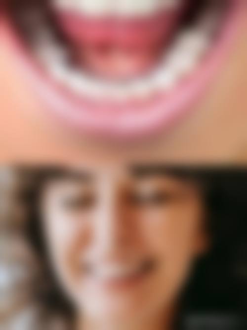 美奥口腔全国连锁有几家？约40 - 43家，分布多城，技术优服务好还能异地复诊！ 