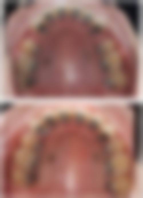 张莹医生:擅长舌侧矫正疑难病例