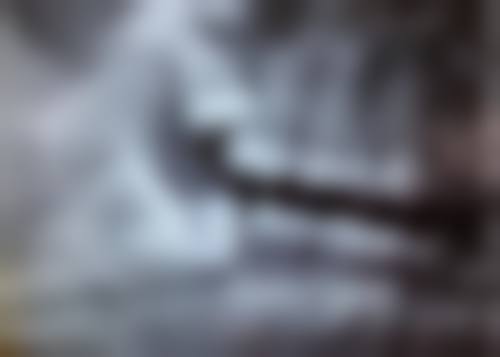 补牙后其他注意事项