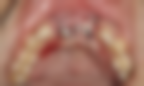 浙江台州三门艺贝口腔地址电话营业时间