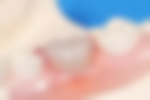 瑞安市人民医院口腔科价格表/收费标准