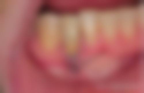 🌟特色项目：满足不同口腔需求