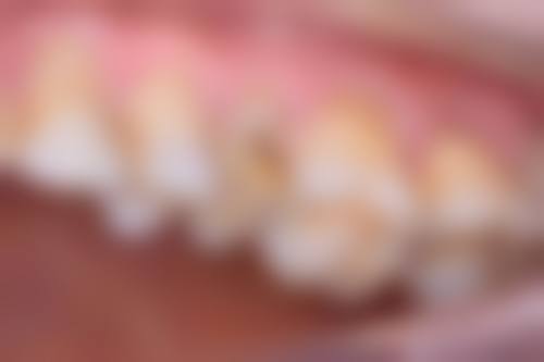 上海丛磊口腔真人口碑评价怎么样？