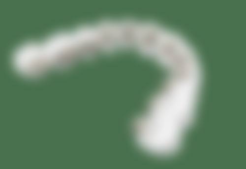 医生解答舌侧矫正价格疑问