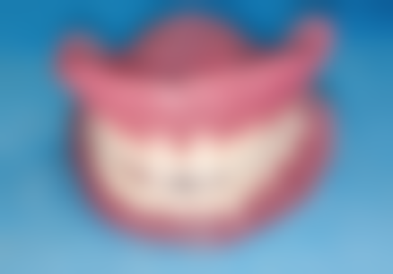 牙龈萎缩导致烤瓷牙掉落后的处理方法