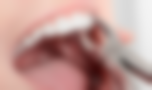 💪德州可恩口腔：隐形矫正技术特色