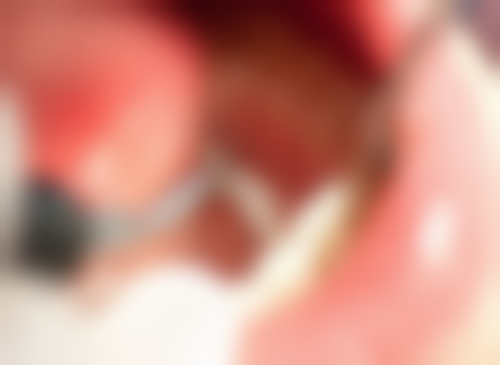 杭州萧山明星路口腔诊所详细的预约挂号方式及流程