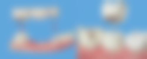 预约流程:轻松预约开启修复之旅