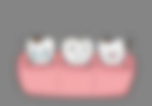 宿州补牙医生24小时在线咨询：宿州市立医院陈德南等专家，补牙技术靠谱可预约 