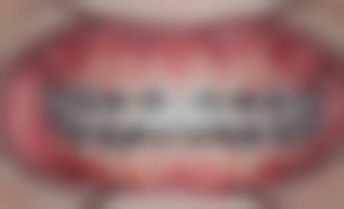 十堰胜元口腔矫正医生特色