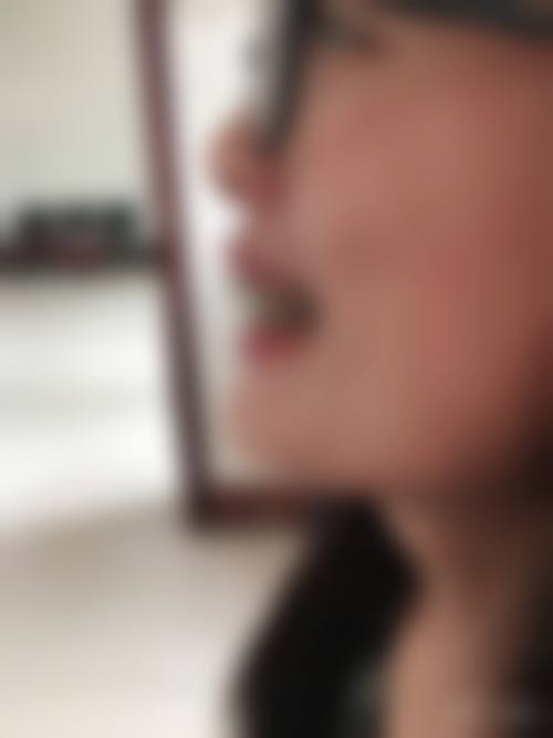 {十堰金属矫正医生在线咨询24小时？十堰华玉/胜元等口腔，正规靠谱+预约挂号方便！ 