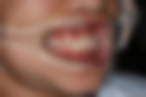 杭州萧山明星路口腔诊所价格表/收费标准