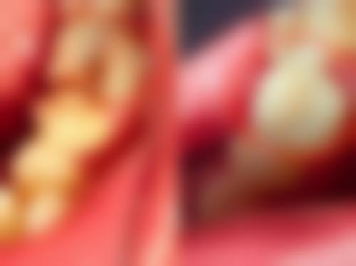 {河南种植牙24小时在线咨询：郑州唯美牙科总院热线0371 - 6031xxx99，多项服务超省心！ 