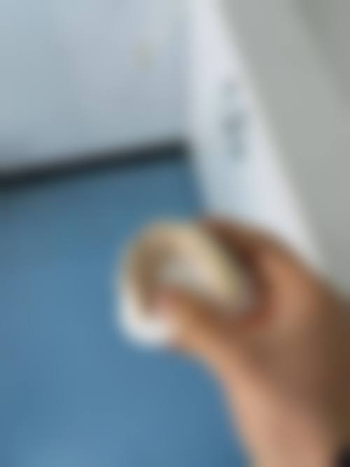 镶牙收费:多种选择满足不同需求