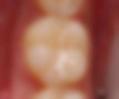 温州王盛口腔真人口碑评价怎么样？