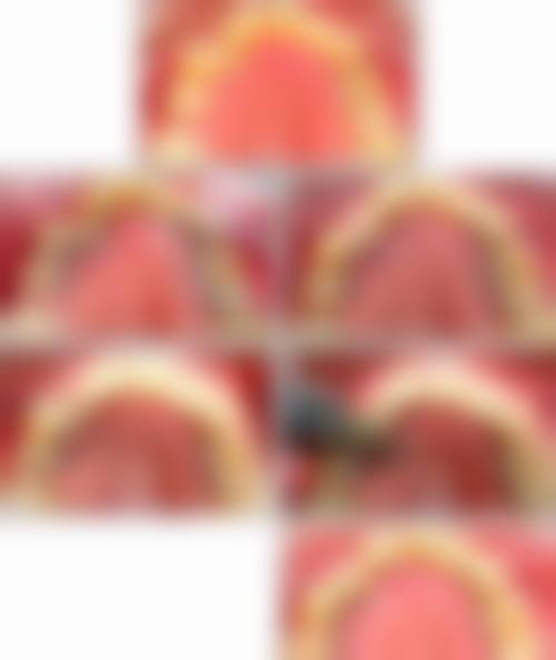 六、乌鲁木齐博峰口腔:贴心服务,多种金属矫正可选