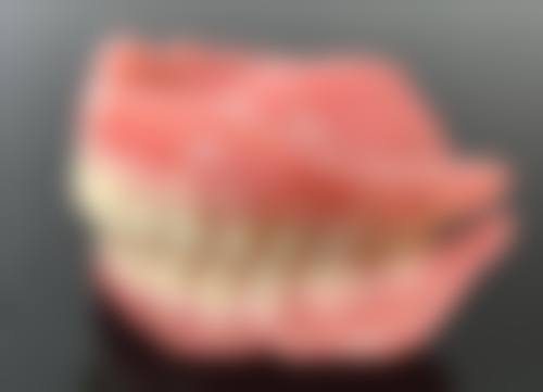 洗牙去除牙结石的原理