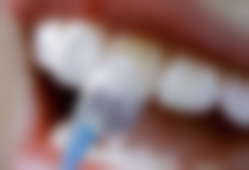 不同地区拔牙报职工医疗保险的差异