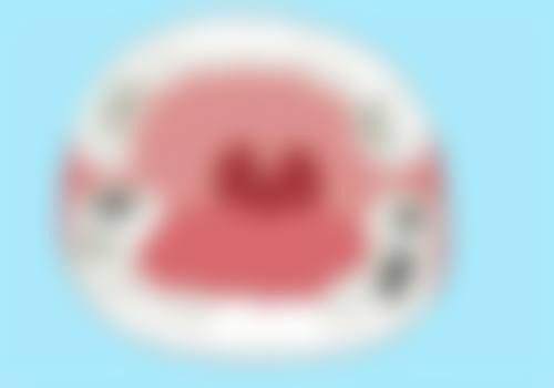 洗牙洗出来好多黑色东西之应对措施