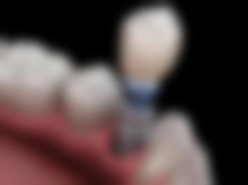 四、超贴心！宁波千口百惠口腔的特色服务体验