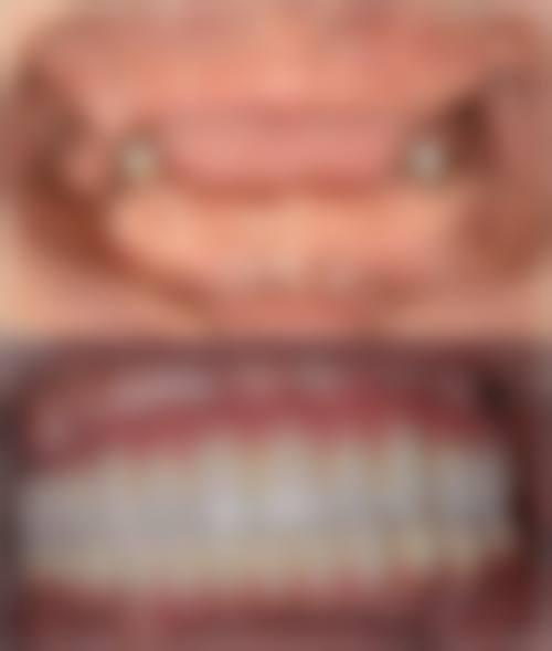 马靖倩医生技术优势