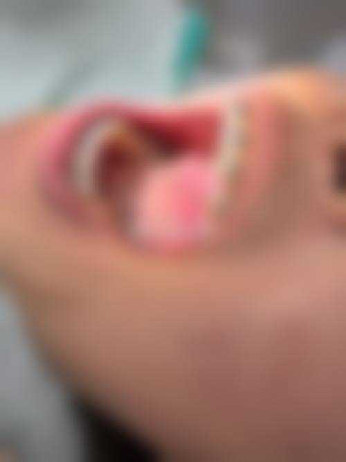 长安固美口腔金属矫正医生优势