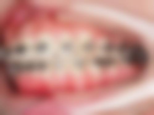 方城县雅美口腔诊所：新兴口腔的潜力之星