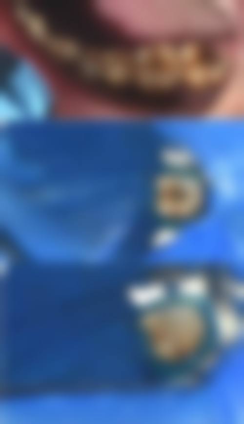 北京冠美口腔（新兴桥）真人口碑评价怎么样？