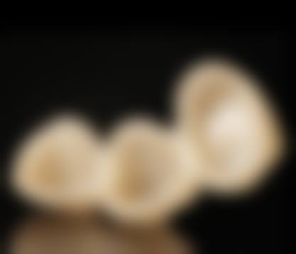 镶牙价格全知晓