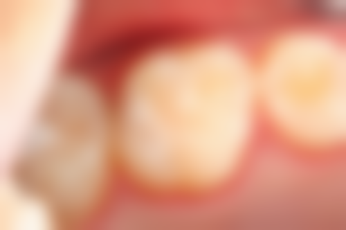 博华口腔门诊部价格表/收费标准